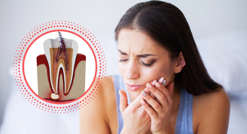 root canal recovery