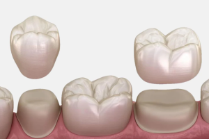 how soon can you start eating after getting dental crown
